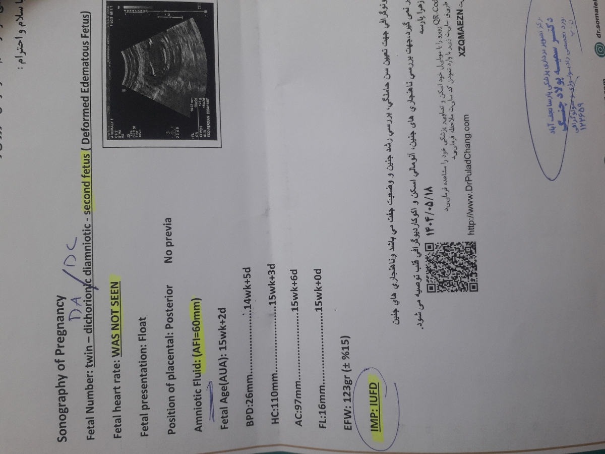 ایست قلبی یکی از قل ها در ۱۵ هفته