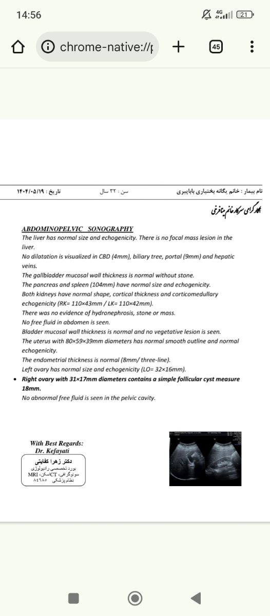 بررسی سونوگرافی شکم .
