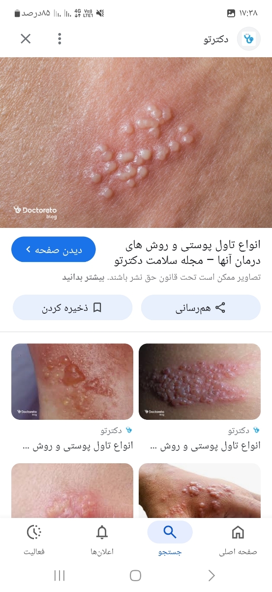 تو رو خدا اینا چیه ابله مرغونه؟... تو رو خدا اینا چیه ابله مرغونه؟...
