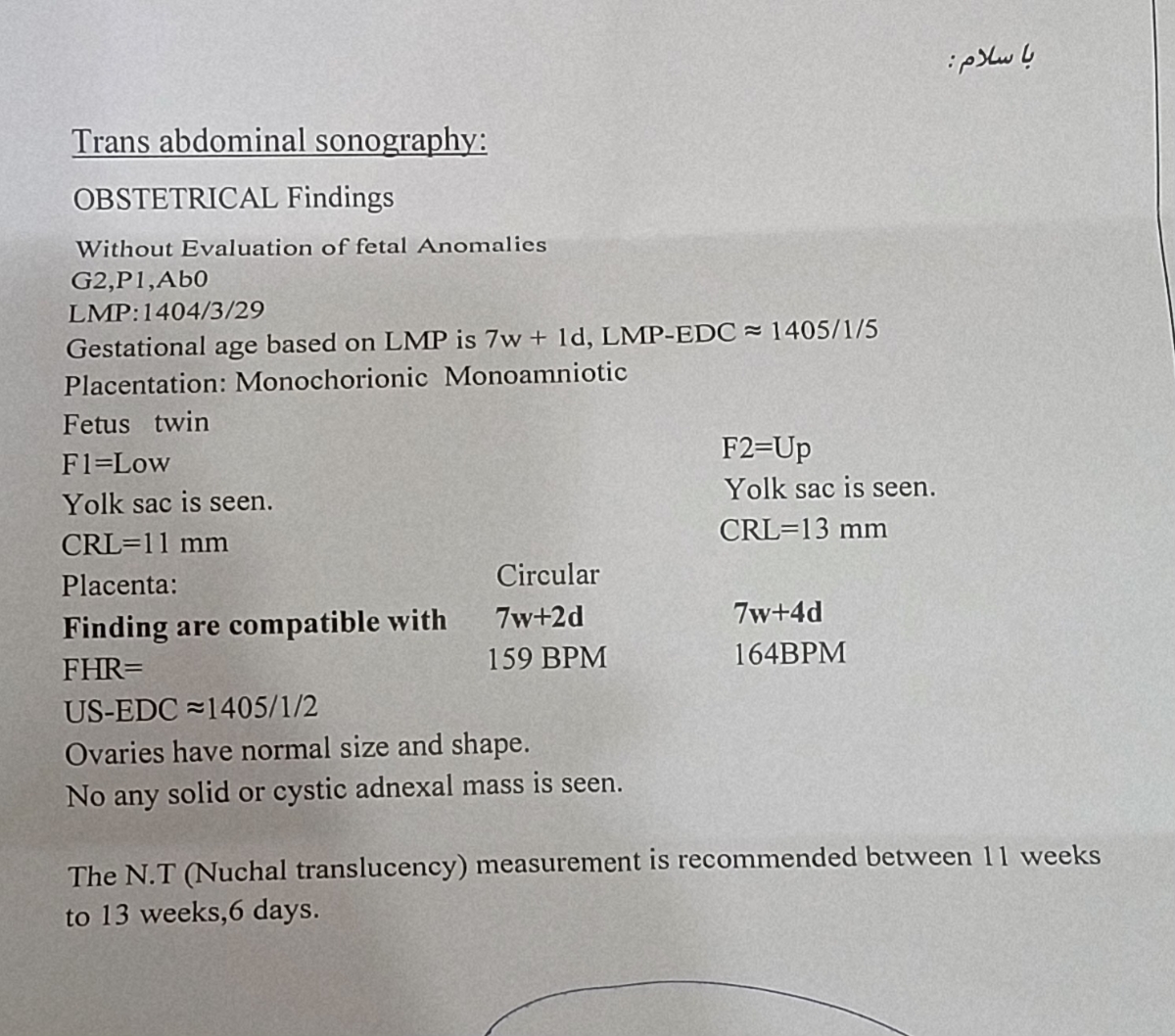 سونوی اول