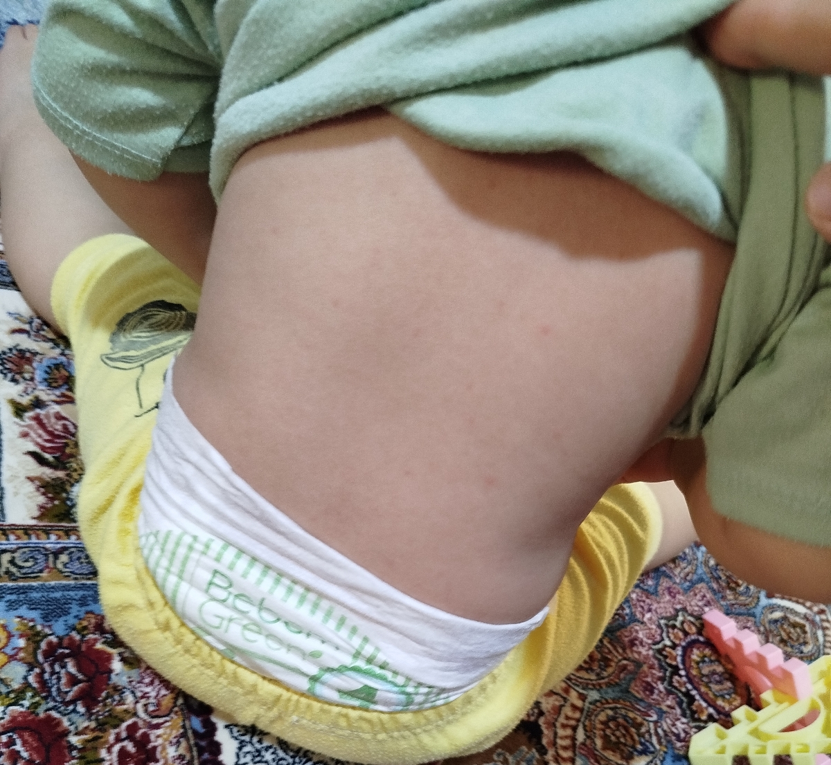 استفراغ بچه یک ساله