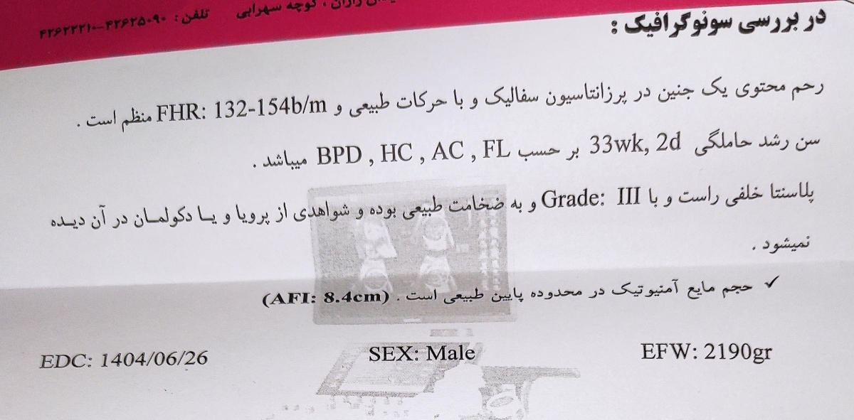 جفت گرید سه درهفته 35 جفت گرید سه درهفته 35