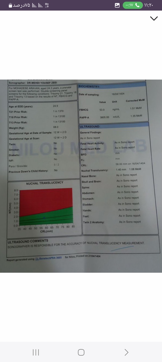 سونو انومالی وکیست ۴ میلی سونو انومالی وکیست ۴ میلی