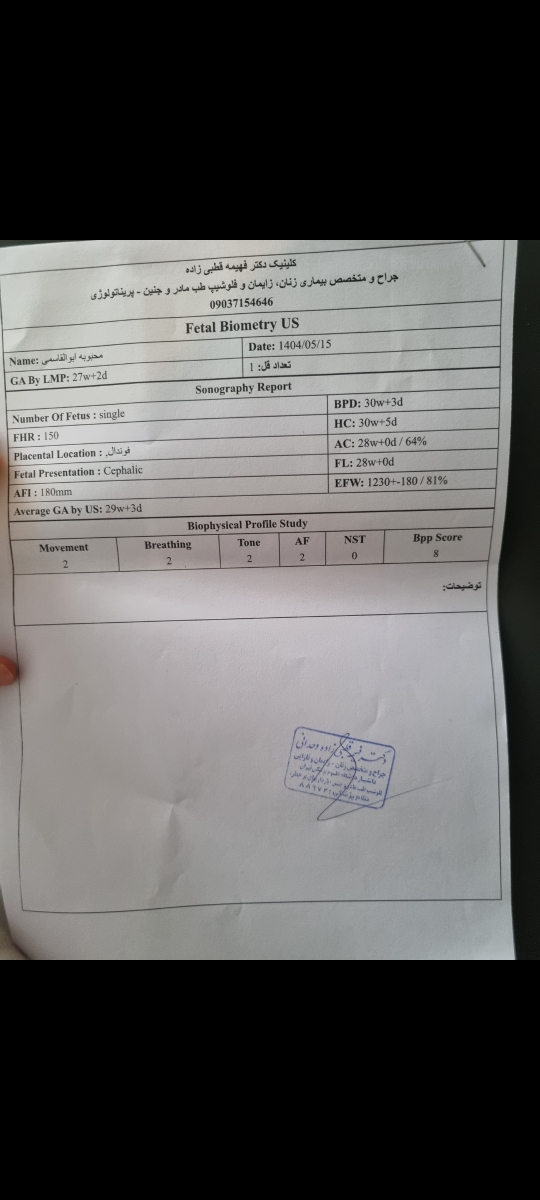 تکان خوردن زیاد جنین