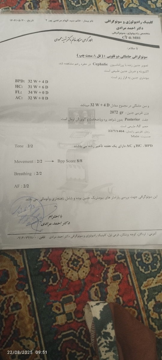 سلام خانم دکتر وخانمایی که دوقلو باردارید لطفا بیاید من خیلی نگرانم!!