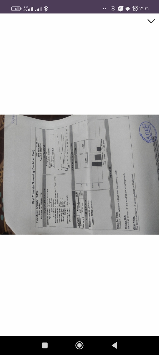 غربالگری دوم من رو چک کنید غربالگری دوم من رو چک کنید