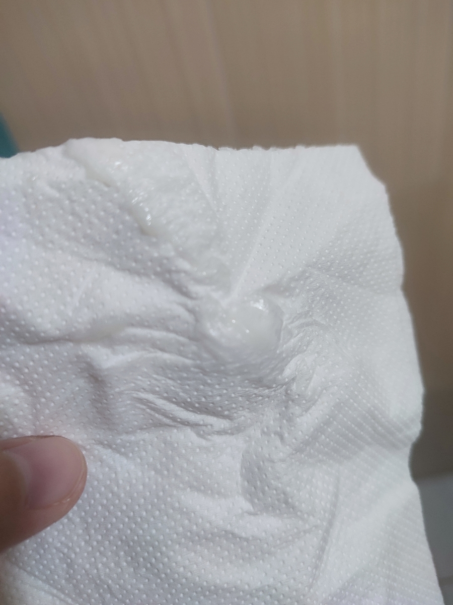 خارش و بیرونی و استفاده از کلوتریمازول موضعی خارش و بیرونی و استفاده از کلوتریمازول موضعی