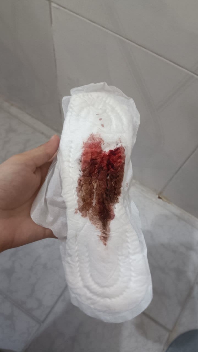 علت لکه بینی قهوه ای در هفته پنجم علت لکه بینی قهوه ای در هفته پنجم
