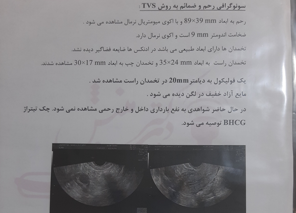 اینه سونوم اینه سونوم