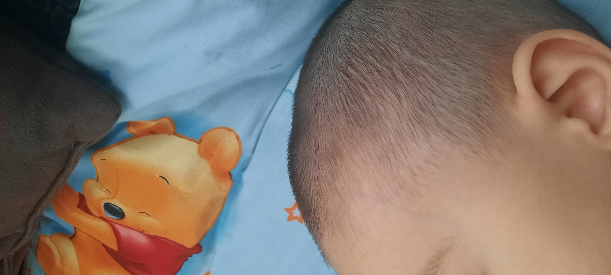 برآمدگی جلو سر برآمدگی جلو سر