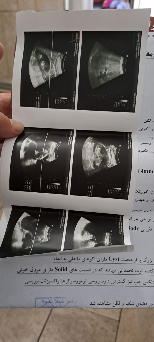 دکتر عزیز سونو گرافی مادرم ببنید تفسیر کنید دکتر عزیز سونو گرافی مادرم ببنید تفسیر کنید