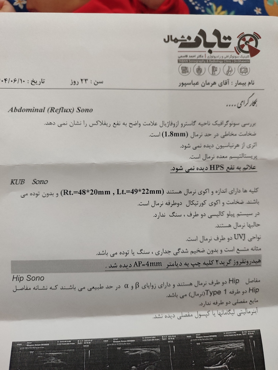 ورم خفیف کلیه نوزاد ورم خفیف کلیه نوزاد