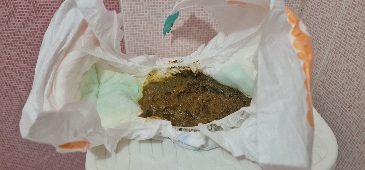 یبوست نوزاد ۹ ماهه