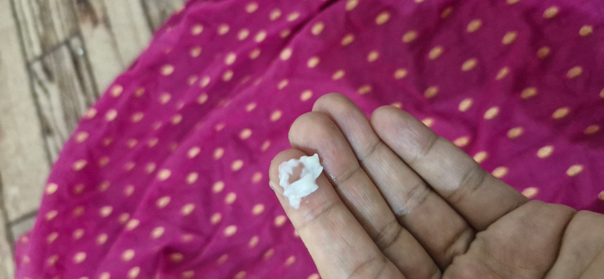 عفونت قارچی یا کاندیدایی واژن