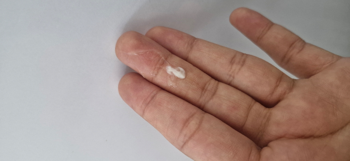 عفونت قارچی یا کاندیدایی واژن