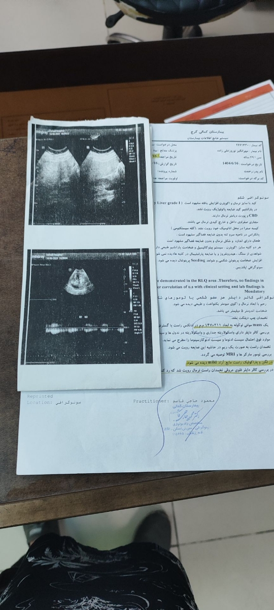 دکتر عزیز سونو گرافی مادرم ببنید تفسیر کنید