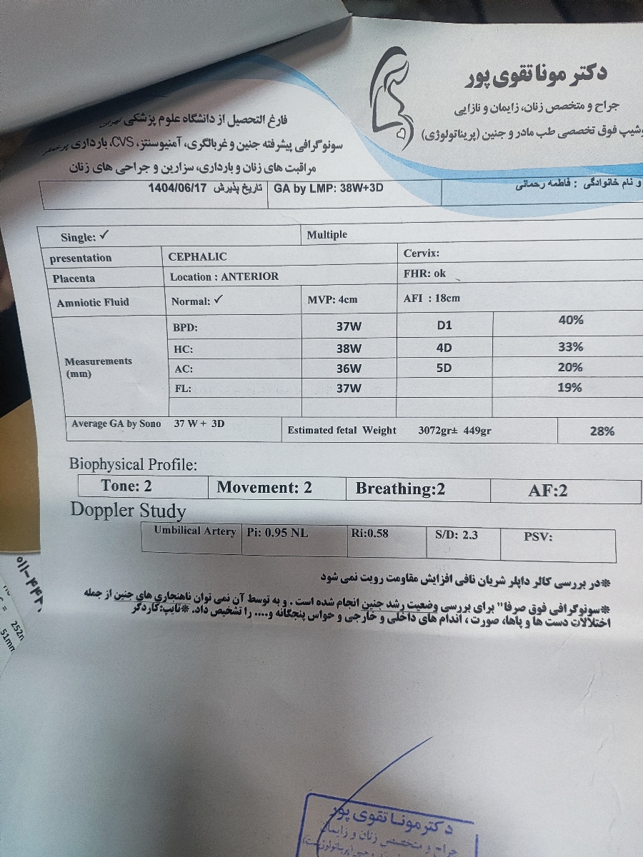 بررسی سونوی وزن در هفته ۳۸ و ۵ روز بررسی سونوی وزن در هفته ۳۸ و ۵ روز
