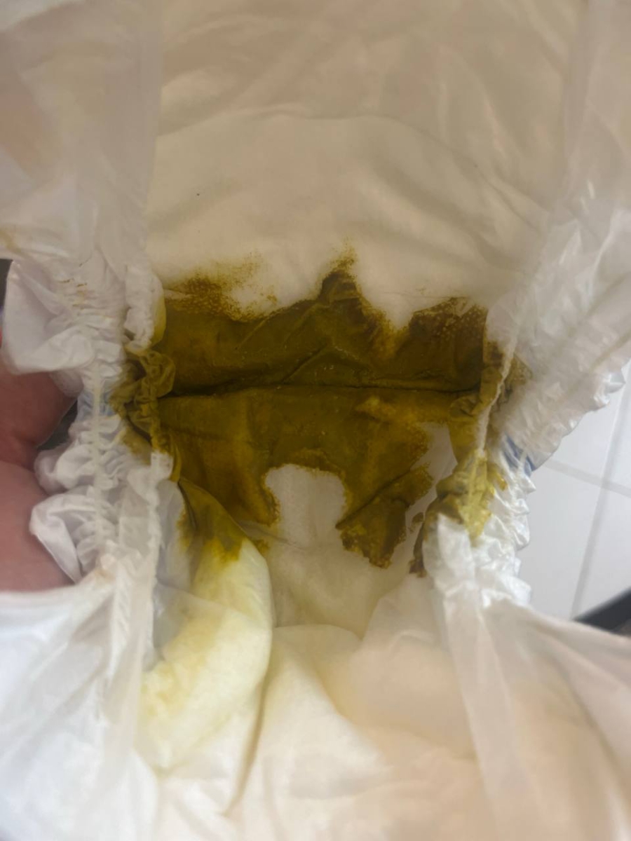 مدفوع سبز لجنی نوزاد نارس