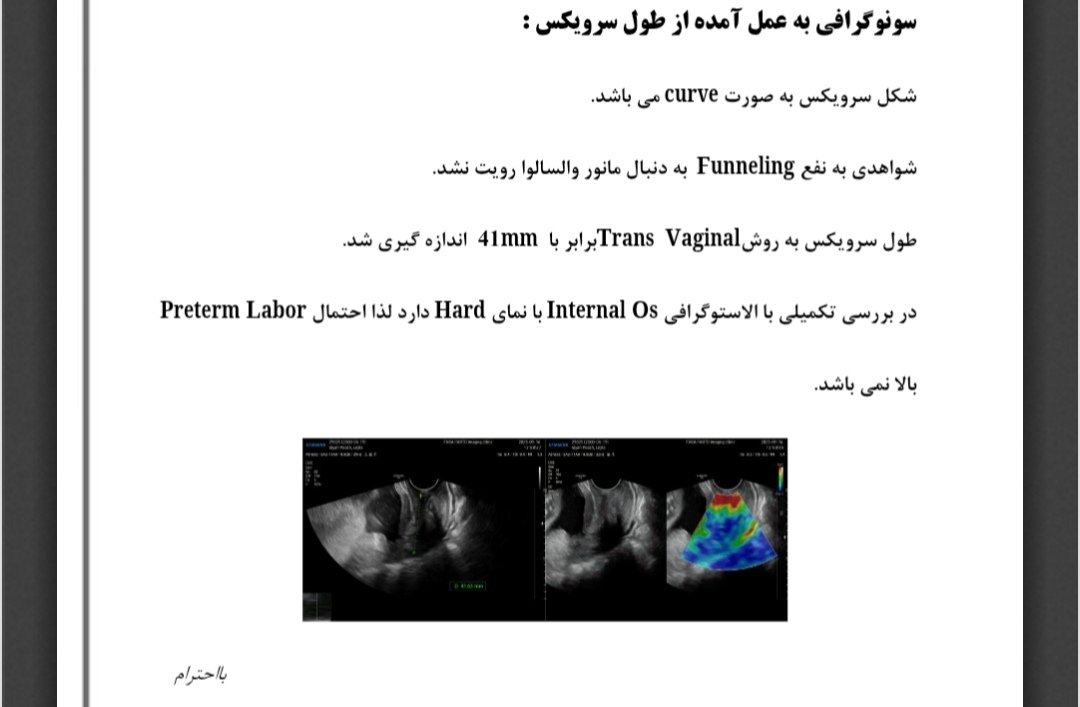 بررسی سونوگرافی طول سرویکس