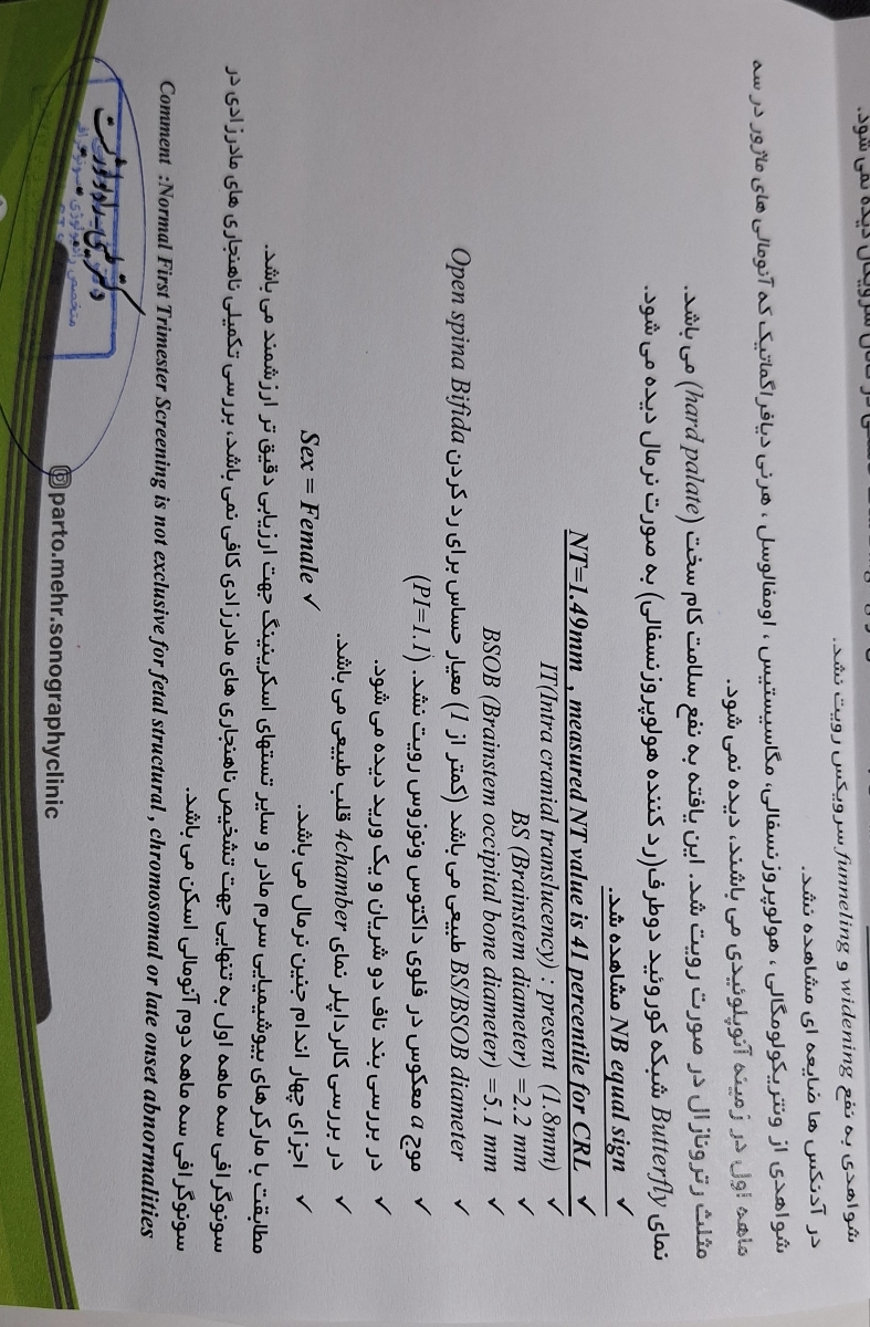 تفسیر سونوی ان تی