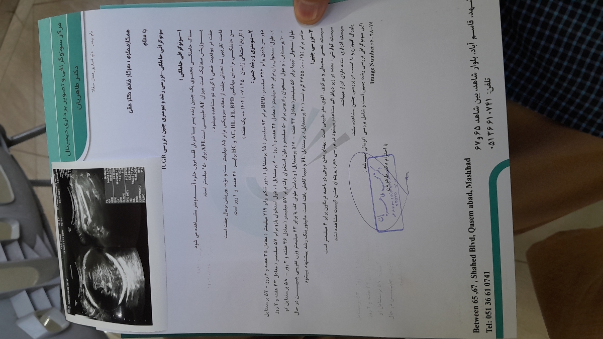 سونو رشد ۳۷ هفته