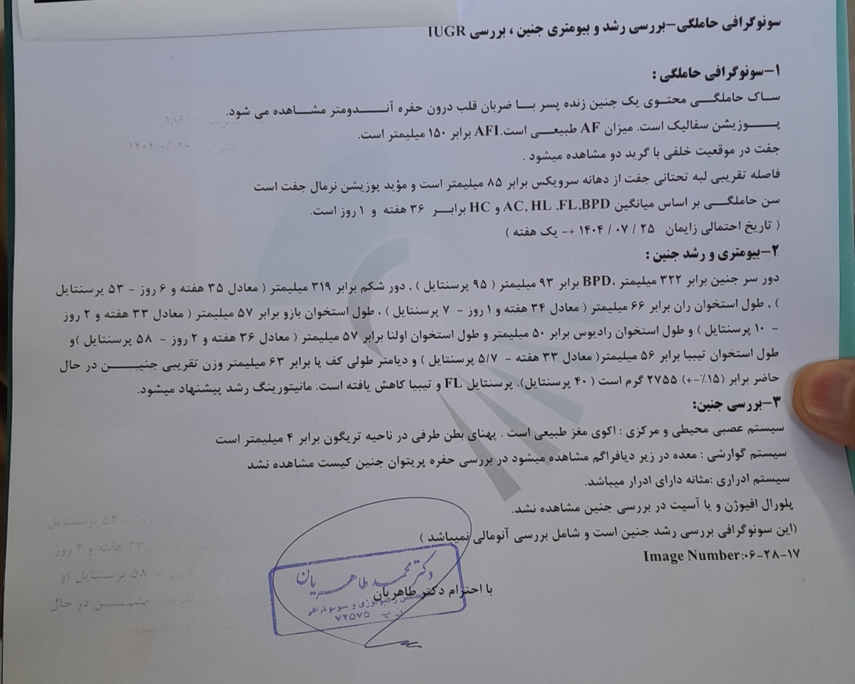 سونو رشد جنین
