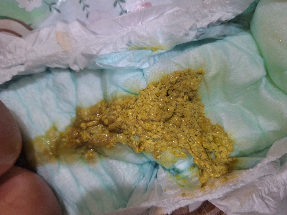 این دفع همین الانش
ببخشید بابت عکس شرمنده 🥲 این دفع همین الانش
ببخشید بابت عکس شرمنده 🥲