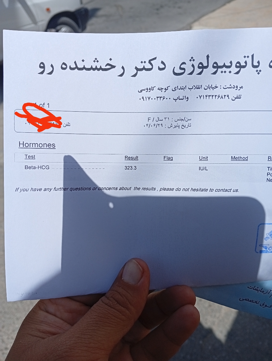 این ازمایش دیروزم بود 