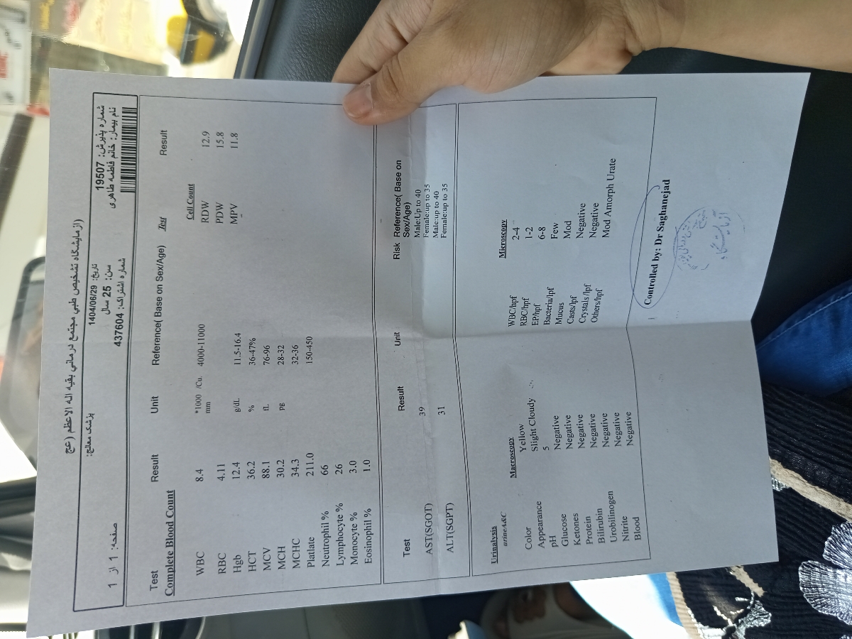 خانمدکتر انزیم کبدی بالاس ازمایش دادم خانمدکتر انزیم کبدی بالاس ازمایش دادم