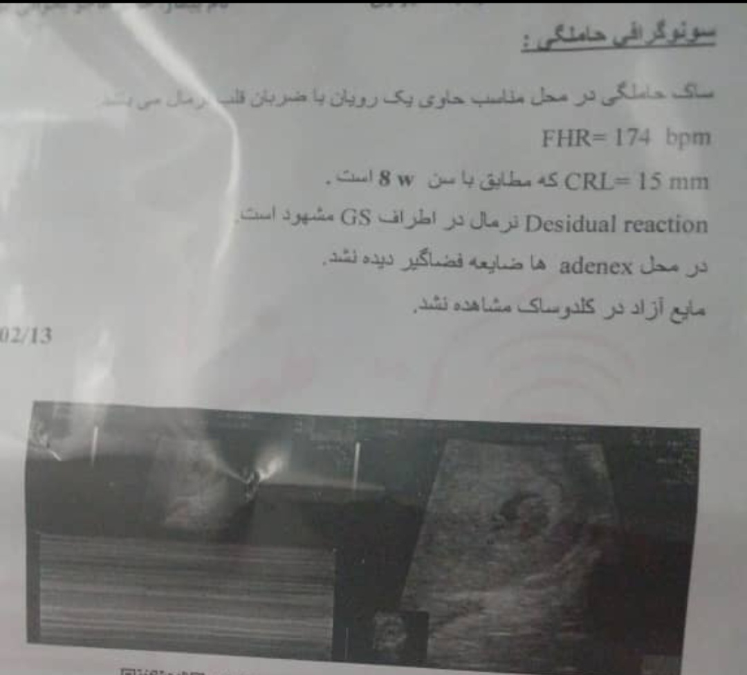 علت لکه بینی در بارداری