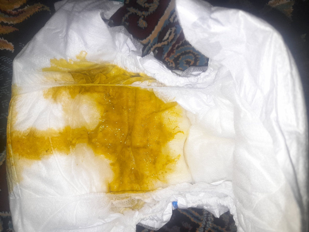 اینا چند نمونه از مدفوع هاش تو یک ماه اخیره