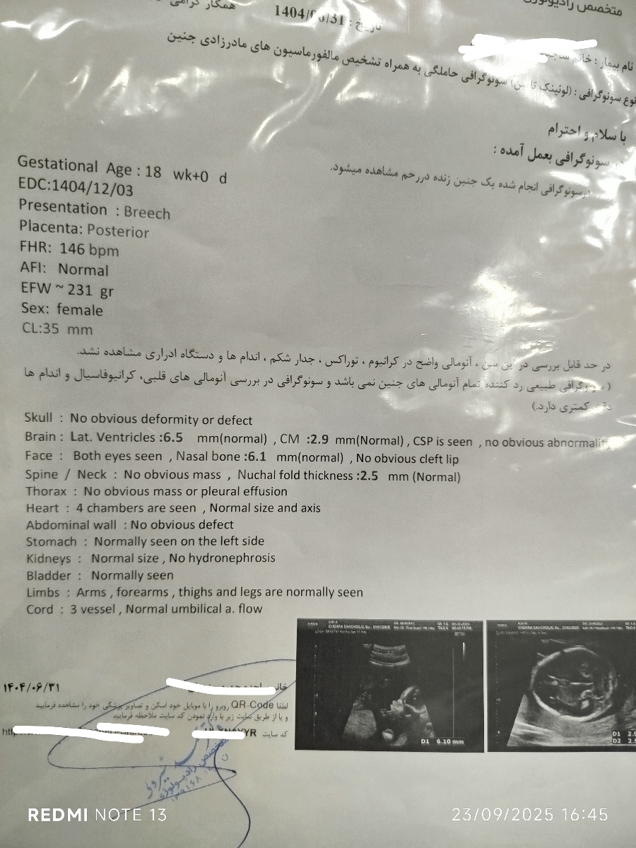 تفسیر سنو آنومالی بارداری