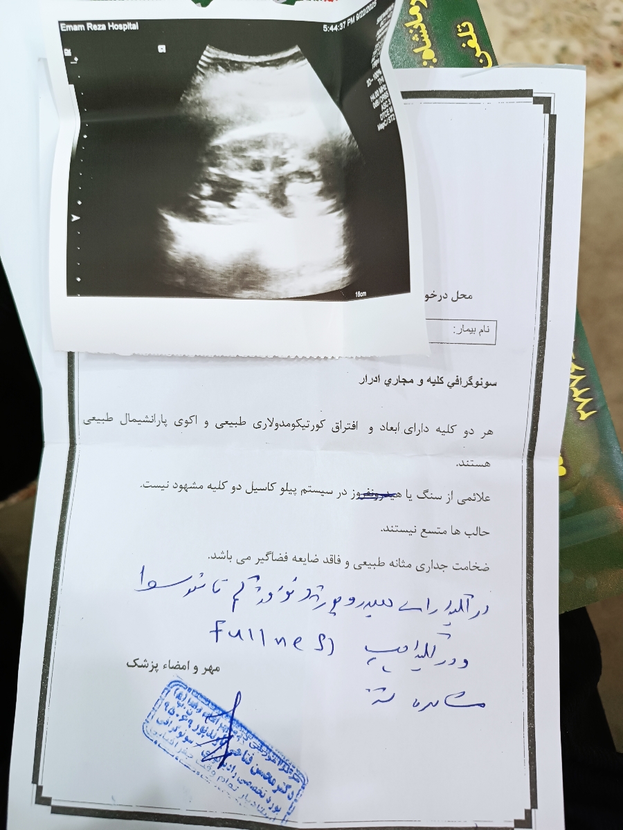 اینم سونو