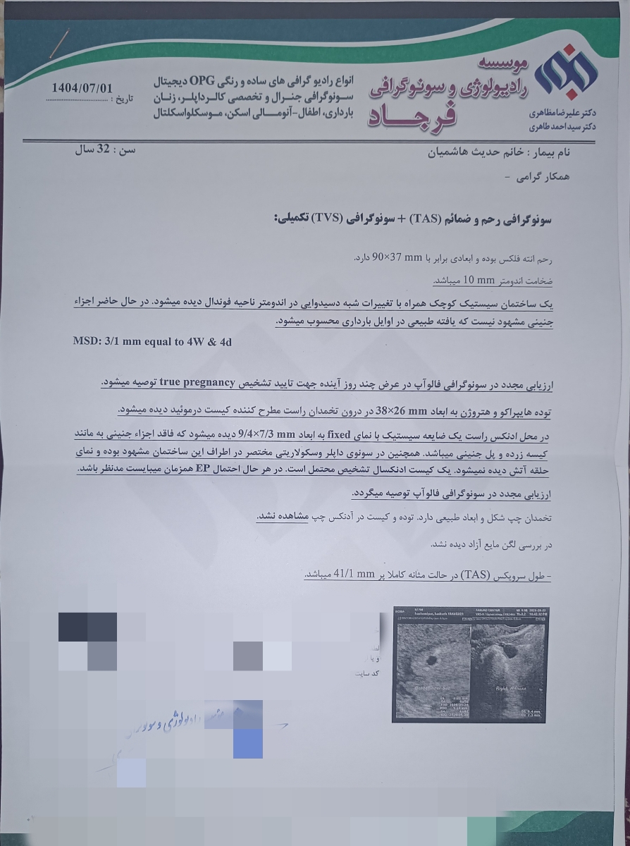 سونوگرافی تشخیص ساک بارداری