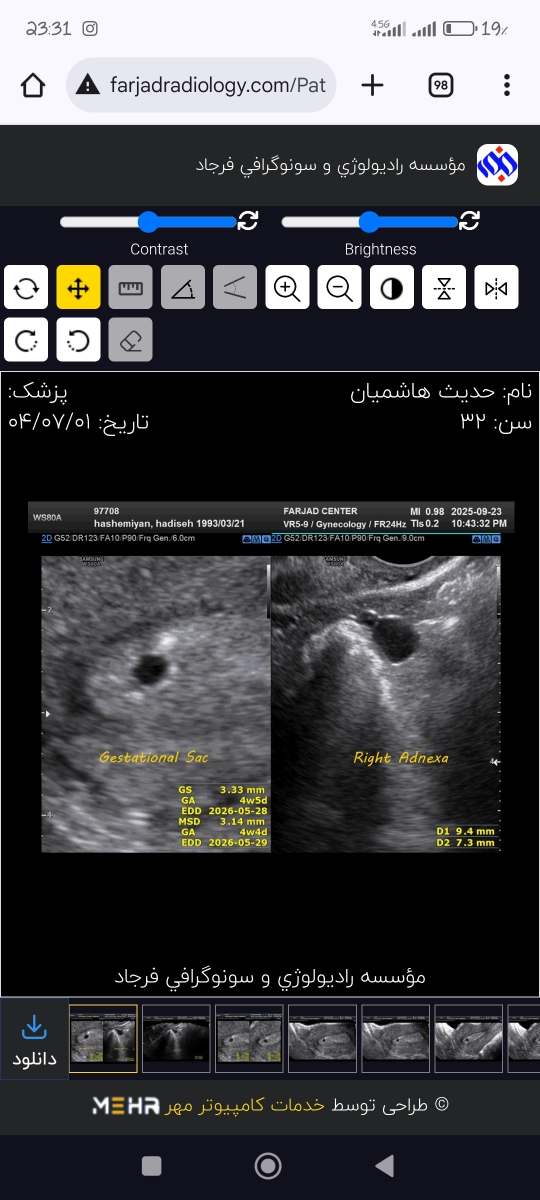 سمت راستی تو لوله راستم.سمت چپی ساک بارداری