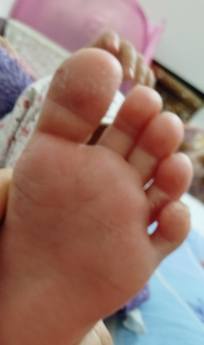 بیشتر دوتا  انگشت شصت و انگشت کوچیکه  فقط یک پا هست 