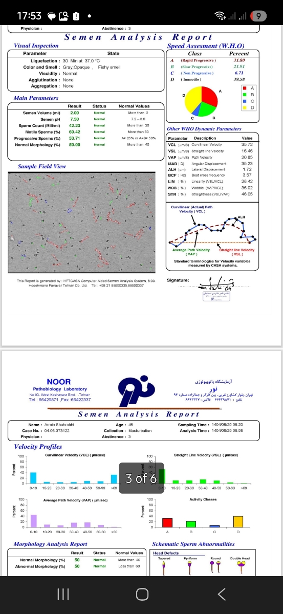 تفسیر آزمایش ذخیره تخمدان تفسیر آزمایش ذخیره تخمدان