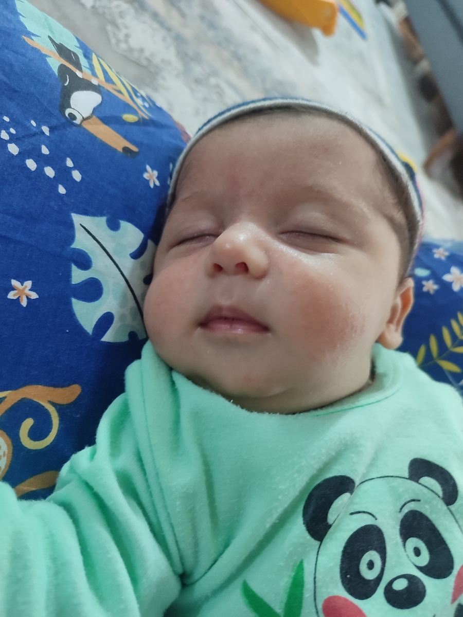 خلط پشت حلق نوزاد