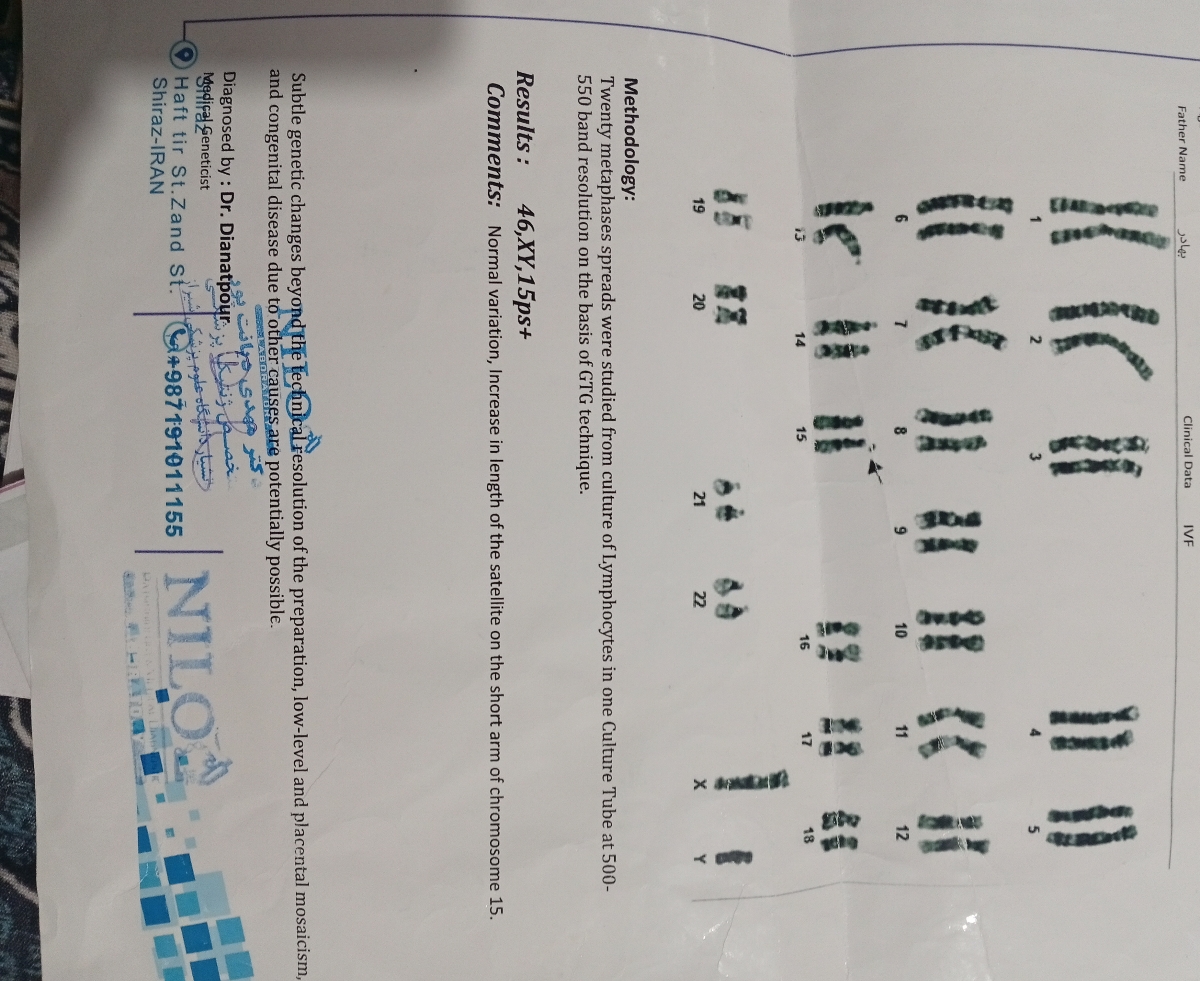 این برای همسرمه