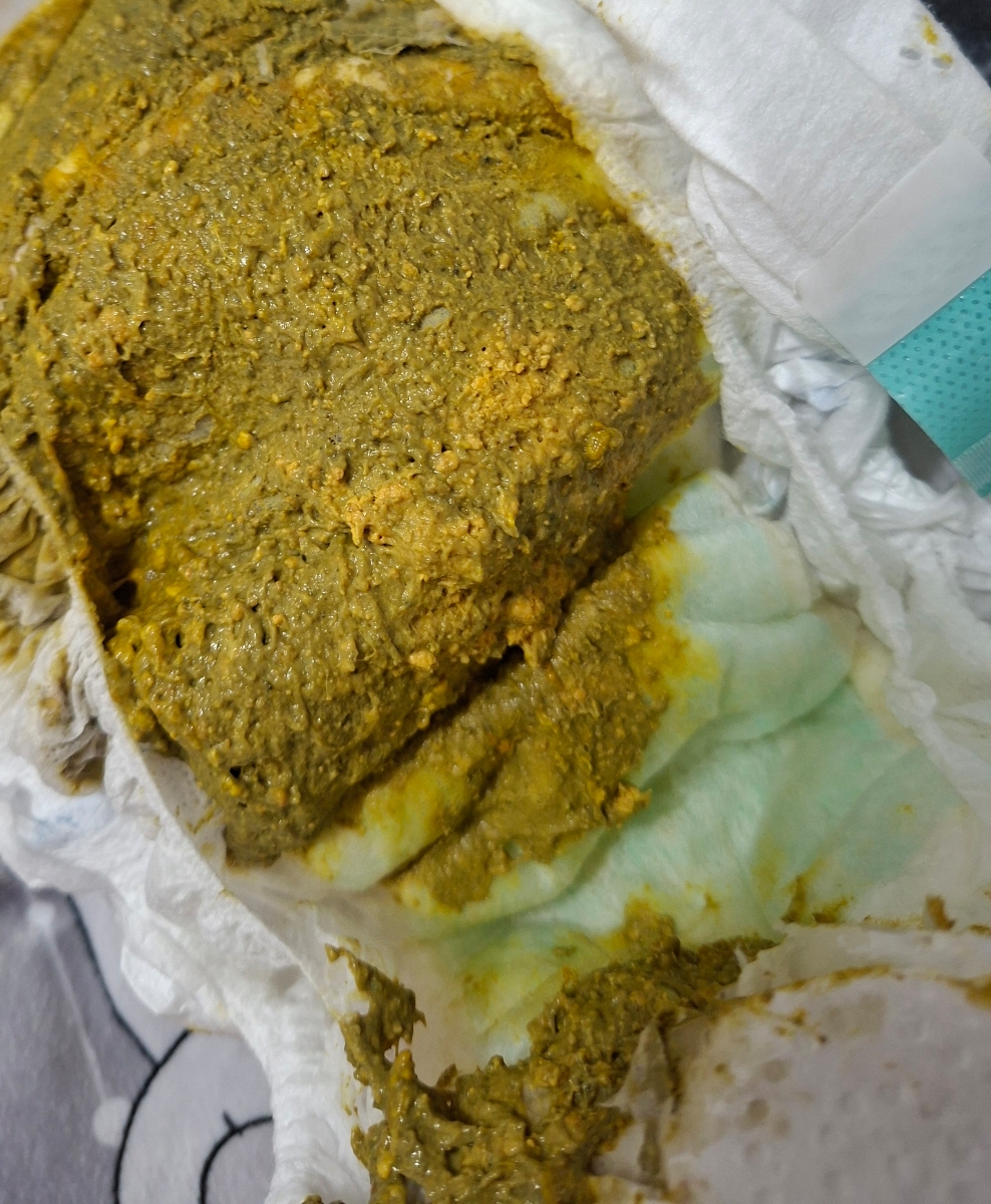 یبوست نوزاد و کار نکردن شکم