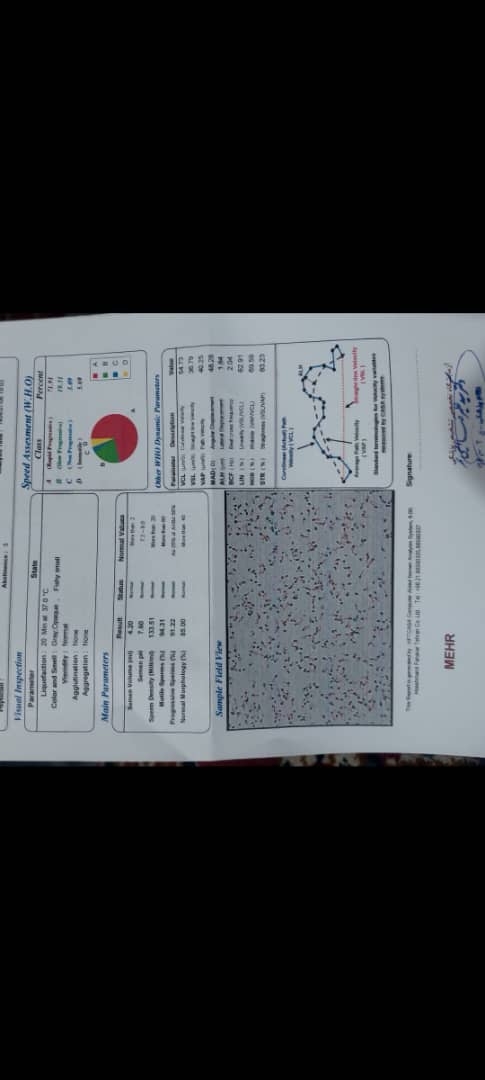تفسیر آزمایش اسپرم یه بنده خدایی