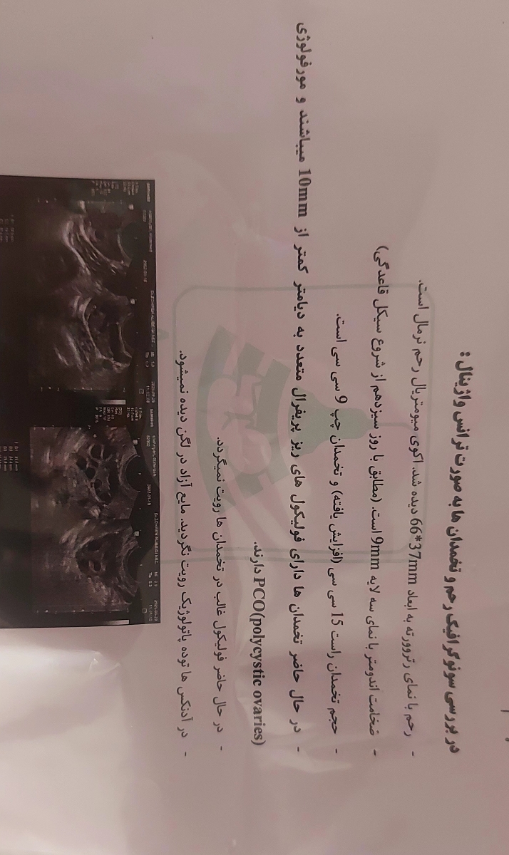 سونو روز ۱۳