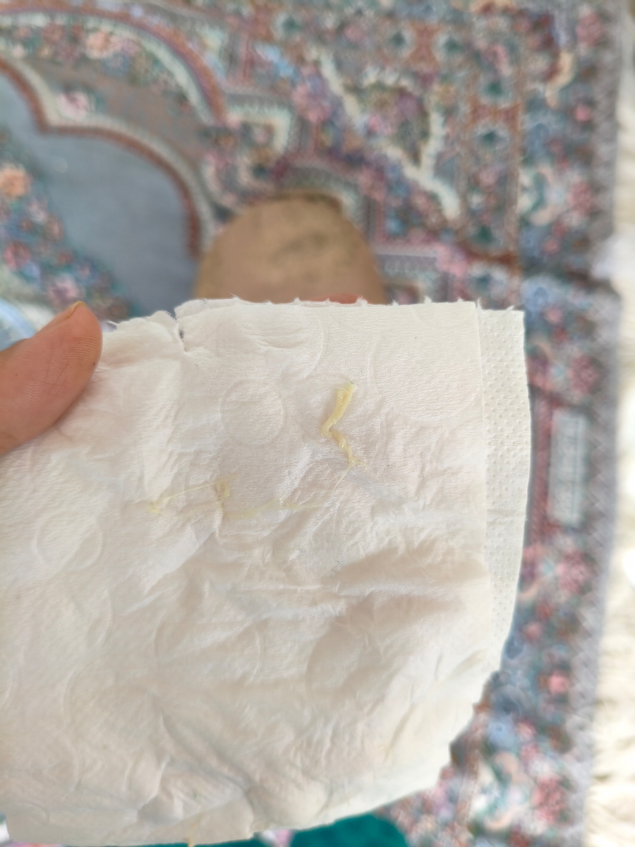 خارش و ترشحات بودار