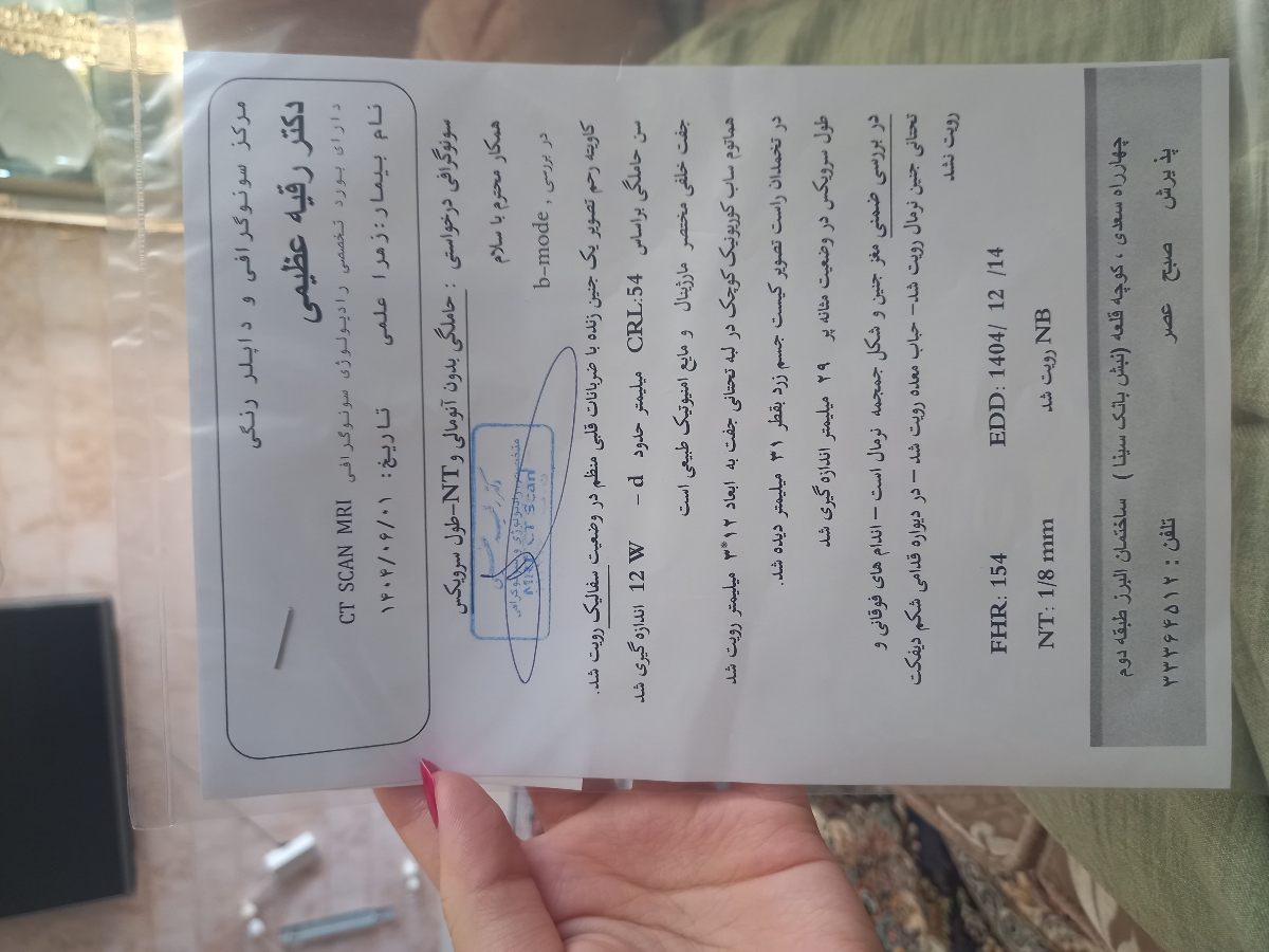 کیست تخمدان در بارداری