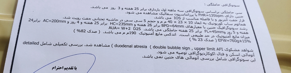 این سونوم