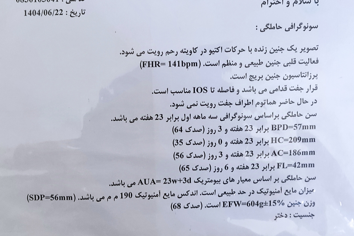 اینم سونویی که یک ماه  بعد از انومالی  انجام دادم هماتومم رفع شده بود