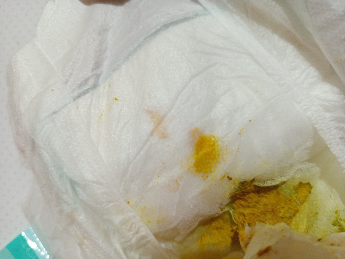 خون در مدفوع نوزاد چند قطره