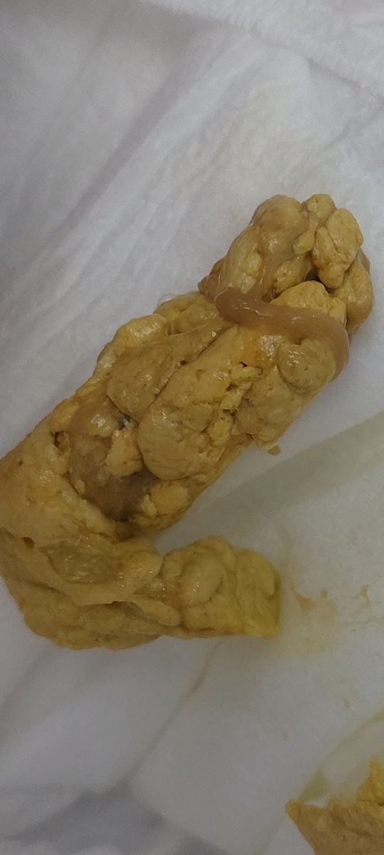 مدفوع خلطی نوزاد دو ماهه مدفوع خلطی نوزاد دو ماهه