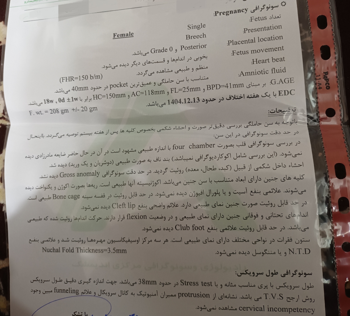تفسیر سونوی انومالی جنین