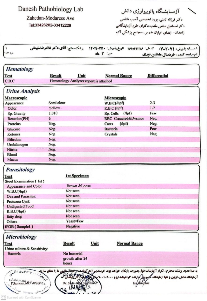 حساسیت به پروتئین گاوی
